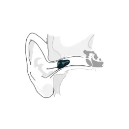 Intra-auriculaire