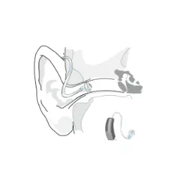 micro-contour